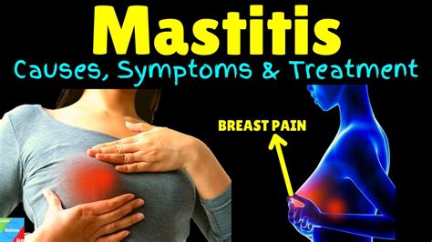 mastitis hole in breast